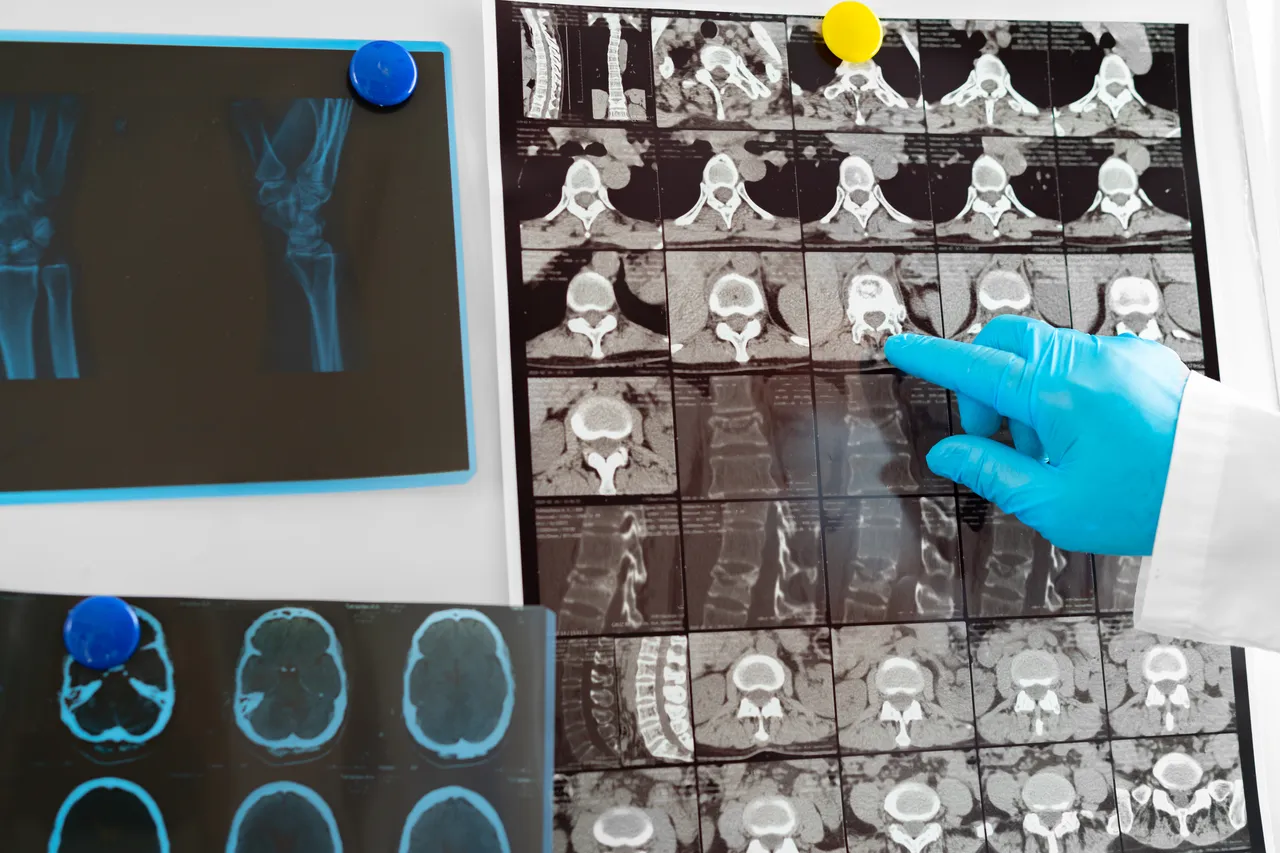 Screening di prevenzione: quando è il momento giusto e perché non dovresti rimandare